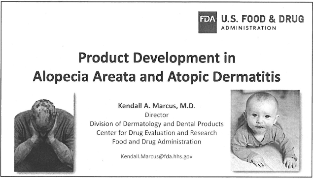 Product Development in Alopecia Areata and Atopic Dermatitis Presentation Cover